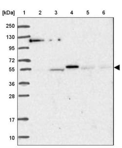 AMIGO Antibody, Novus Biologicals 0.1mL; Unlabeled:Antibodies, Polyclonal