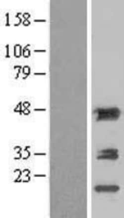 Novus Biologicals™ Aminoacylase/ACY1 Overexpression Lysate