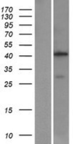 Novus Biologicals&trade;&nbsp;Aminomethyltransferase Overexpression Lysate