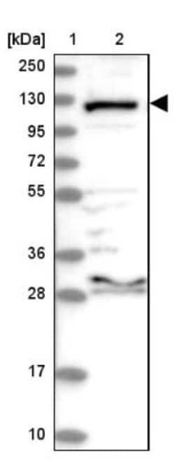 Aminopeptidase LRAP/ERAP2 Antibody, Novus Biologicals:Antibodies:Primary