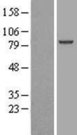 Novus Biologicals&trade;&nbsp;Aminopeptidase O/ONPEP Overexpression Lysate