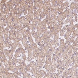 Aminopeptidase LRAP/ERAP2 Antibody, Novus Biologicals:Antibodies:Primary