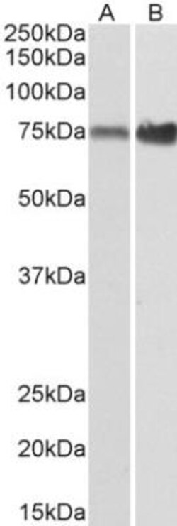 Aminopeptidase P1/XPNPEP1 Antibody, Novus Biologicals 0.1mg; Unlabeled:Antibodies,