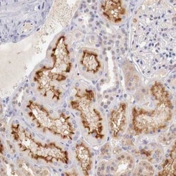 Aminopeptidase P2/XPNPEP2 Antibody, Novus Biologicals 25 &mu;L; Unlabeled:Antibodies,