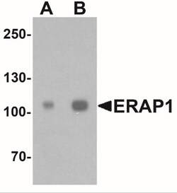 Aminopeptidase PILS/ARTS1 Antibody - BSA Free, Novus Biologicals:Antibodies:Primary