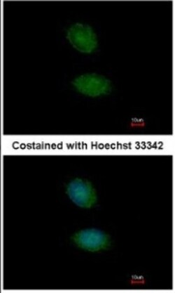 AMMECR1 Antibody, Novus Biologicals 0.1mL; Unlabeled:Antibodies, Polyclonal