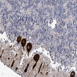 AMMECR1 Antibody, Novus Biologicals:Antibodies:Primary Antibodies