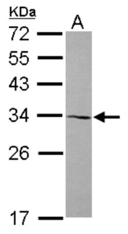 AMMECR1 Antibody, Novus Biologicals 0.1mL; Unlabeled:Antibodies, Polyclonal