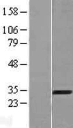 Novus Biologicals&trade;&nbsp;AMMECR1 Overexpression Lysate