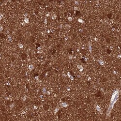 AMN1 Antibody, Novus Biologicals 25 &mu;L; Unlabeled:Antibodies, Polyclonal