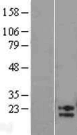 Novus Biologicals&trade;&nbsp;AMN1 Overexpression Lysate