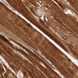 AMPD1 Antibody, Novus Biologicals:Antibodies:Primary Antibodies