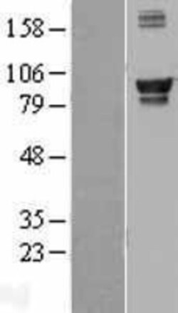 Novus Biologicals™ AMPD1 Overexpression Lysate