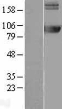 Novus Biologicals&trade;&nbsp;AMPD2 Overexpression Lysate
