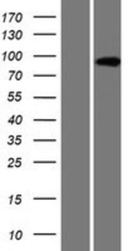 Novus Biologicals™ AMPD3 Overexpression Lysate