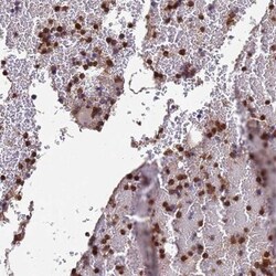 AMPD3 Antibody, Novus Biologicals:Antibodies:Primary Antibodies