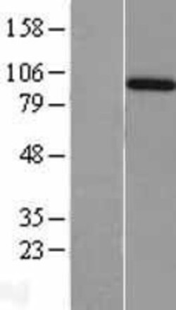 Novus Biologicals&trade;&nbsp;Amphiphysin/AMPH Overexpression Lysate