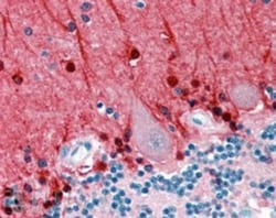 Amphiphysin/AMPH Antibody, Novus Biologicals 0.1mg; Unlabeled:Antibodies,