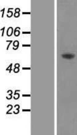 Novus Biologicals&trade;&nbsp;AMPK alpha 2 Overexpression Lysate