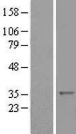 Novus Biologicals AMPK beta 1 Overexpression Lysate 0.1mg:Protein Analysis