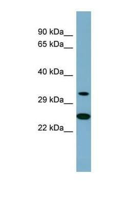 AMPK beta 2/PRKAB2 Antibody, Novus Biologicals:Antibodies:Primary Antibodies