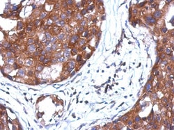 AMSH/STAMBP Antibody, Novus Biologicals 0.1mL; Unlabeled:Antibodies, Polyclonal