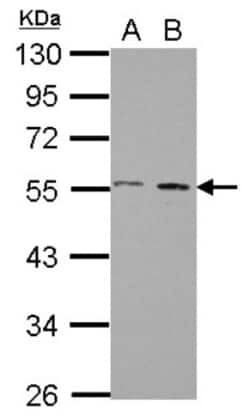 AMSH/STAMBP Antibody, Novus Biologicals 0.1mL; Unlabeled:Antibodies, Polyclonal