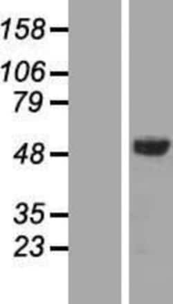 Novus Biologicals&trade;&nbsp;AMSH/STAMBP Overexpression Lysate
