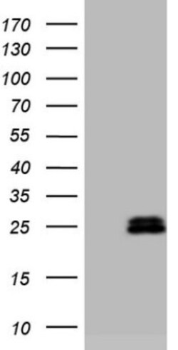AMTN Antibody (OTI2D9), Novus Biologicals 0.1mL; Unlabeled:Antibodies,