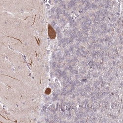 AMTN Antibody, Novus Biologicals 25 &mu;L; Unlabeled:Antibodies, Polyclonal