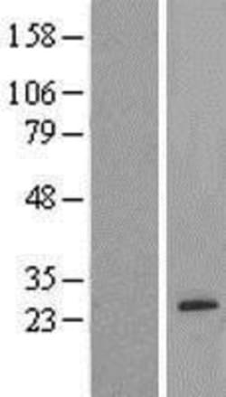 Novus Biologicals&trade;&nbsp;AMTN Overexpression Lysate