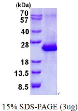 Novus Biologicals&trade;&nbsp;Recombinant Human AMTN His Protein