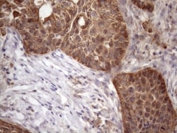 AMTN Antibody (OTI2D9), Novus Biologicals 0.1mL; Unlabeled:Antibodies,