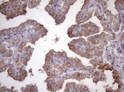 AMTN Antibody (OTI2D9), Novus Biologicals 0.1mL; Unlabeled:Antibodies,