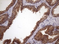 AMTN Antibody (OTI2D9), Novus Biologicals 0.1mL; Unlabeled:Antibodies,