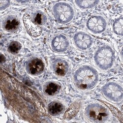 AMTN Antibody, Novus Biologicals 25 &mu;L, Unlabeled:Antibodies, Polyclonal