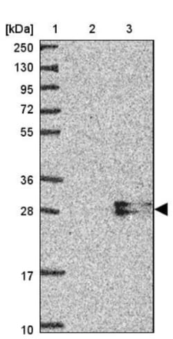 AMTN Antibody, Novus Biologicals 25 &mu;L, Unlabeled:Antibodies, Polyclonal