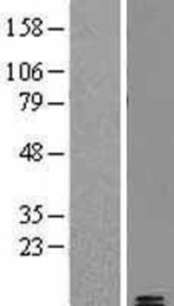 Novus Biologicals&trade;&nbsp;Amylin Overexpression Lysate