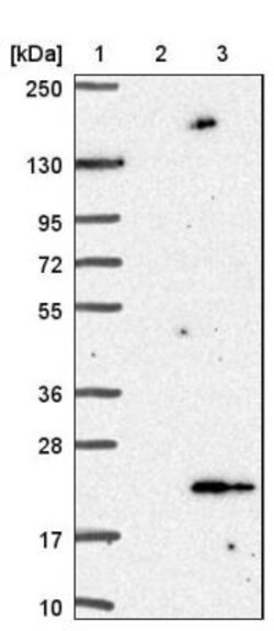 ANAPC13 Antibody, Novus Biologicals 0.1mL; Unlabeled:Antibodies, Polyclonal
