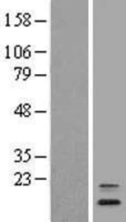 Novus Biologicals™ ANAPC16 Overexpression Lysate