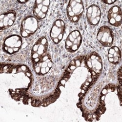 ANAPC16 Antibody, Novus Biologicals:Antibodies:Primary Antibodies