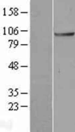 Novus Biologicals&trade;&nbsp;ANAPC2 Overexpression Lysate