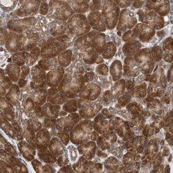 Ancient ubiquitous protein 1 Antibody, Novus Biologicals 25 &mu;L; Unlabeled:Antibodies,