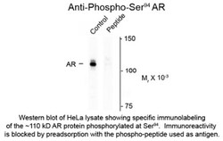 Androgen R/NR3C4, p Ser94 Antibody, Novus Biologicals 0.1mL; Unlabeled:Antibodies,