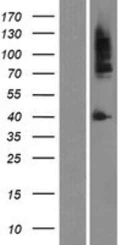 Novus Biologicals&trade;&nbsp;Androgen R/NR3C4 Overexpression Lysate