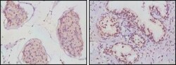 Androgen R/NR3C4 Antibody (2H8) - BSA Free, Novus Biologicals 0.1mL; Unlabeled:Antibodies,