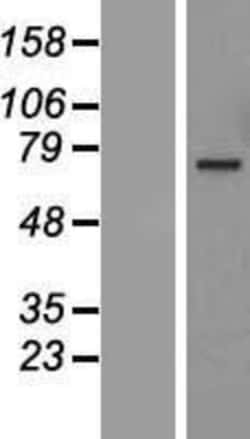 Novus Biologicals&trade;&nbsp;ANGEL1 Overexpression Lysate