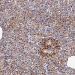 ANGEL1 Antibody, Novus Biologicals:Antibodies:Primary Antibodies