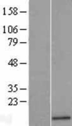 Novus Biologicals&trade;&nbsp;Angiogenin Overexpression Lysate