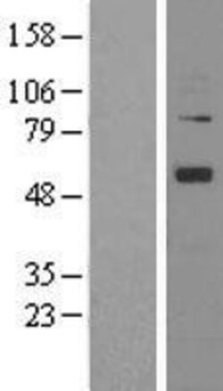 Novus Biologicals&trade;&nbsp;Angiopoietin-1 Overexpression Lysate